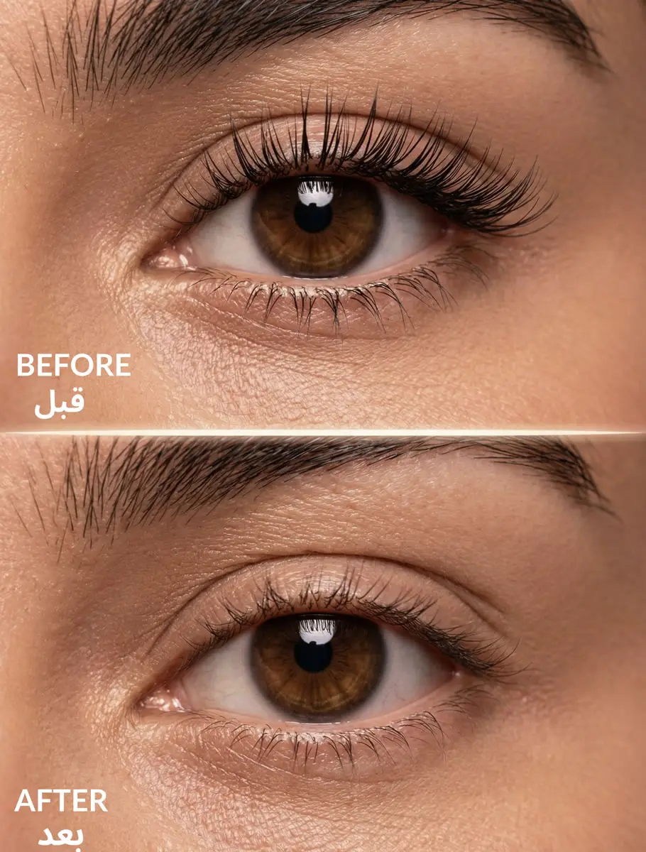 Lala Bouya-before-after